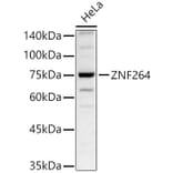 Western Blot - Anti-ZNF264 Antibody (A329980) - Antibodies.com