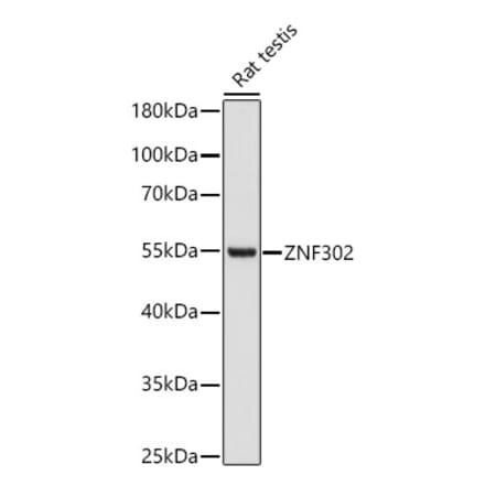 Western Blot - Anti-ZNF302 Antibody (A329981) - Antibodies.com