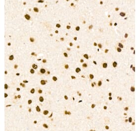 Immunohistochemistry - Anti-ZNF324 Antibody (A329982) - Antibodies.com