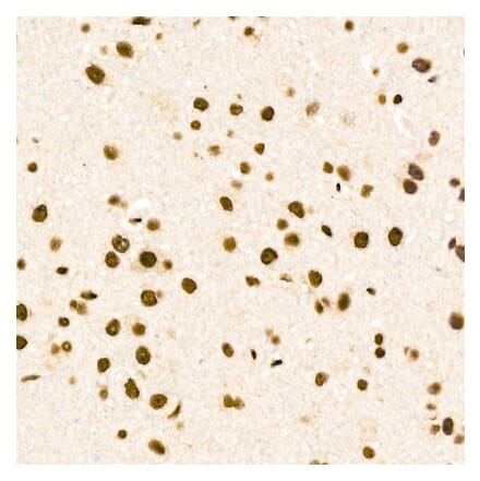 Immunohistochemistry - Anti-ZNF324 Antibody (A329982) - Antibodies.com