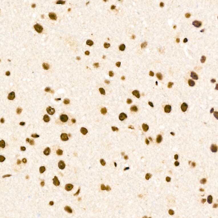 Immunohistochemistry - Anti-ZNF324 Antibody (A329982) - Antibodies.com