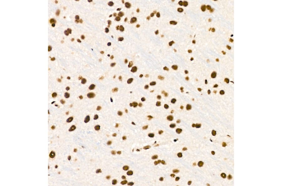Immunohistochemistry - Anti-ZNF324 Antibody (A329982) - Antibodies.com