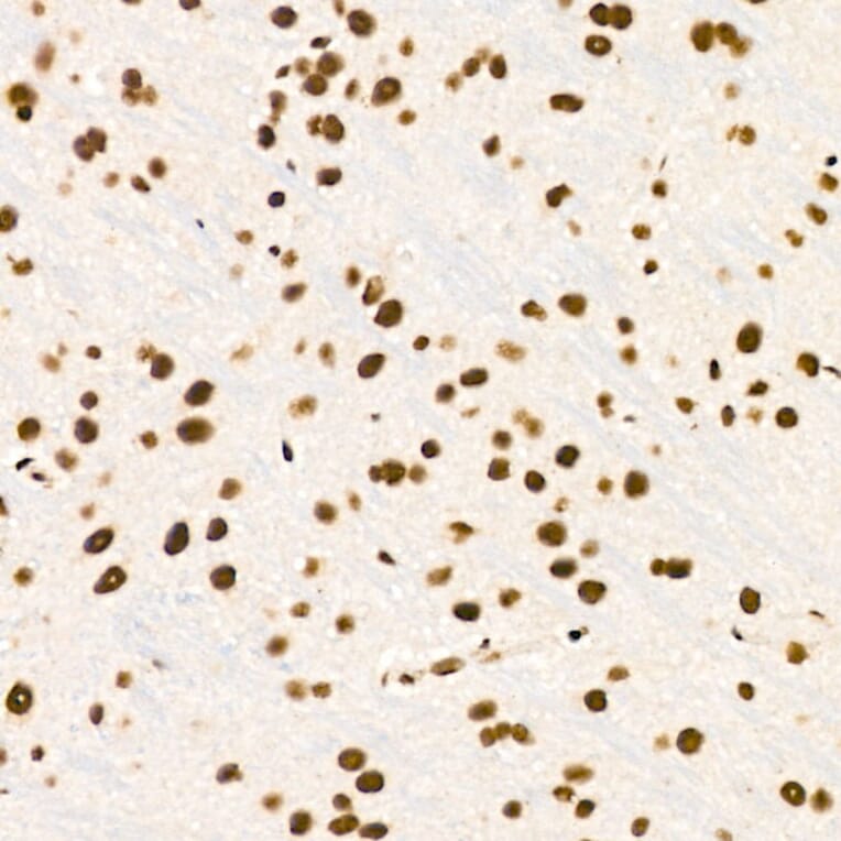 Immunohistochemistry - Anti-ZNF324 Antibody (A329982) - Antibodies.com