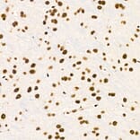 Immunohistochemistry - Anti-ZNF324 Antibody (A329982) - Antibodies.com