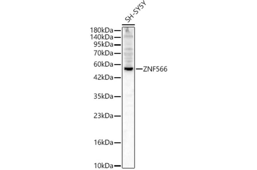 Western Blot - Anti-ZNF566 Antibody (A329983) - Antibodies.com