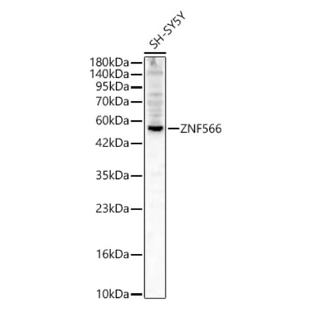 Western Blot - Anti-ZNF566 Antibody (A329983) - Antibodies.com