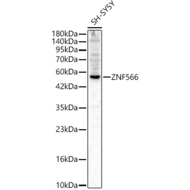 Western Blot - Anti-ZNF566 Antibody (A329983) - Antibodies.com