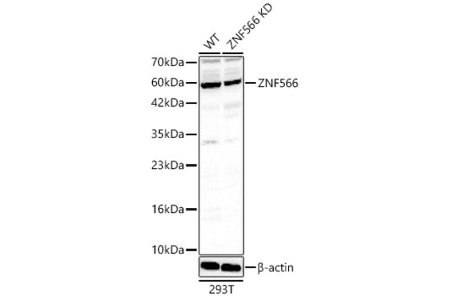 Western Blot - Anti-ZNF566 Antibody (A329983) - Antibodies.com