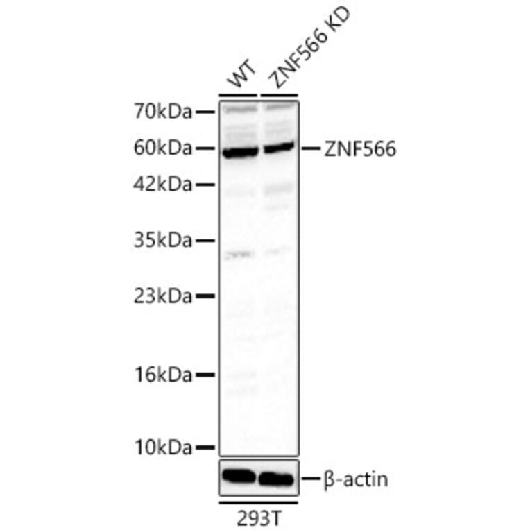 Western Blot - Anti-ZNF566 Antibody (A329983) - Antibodies.com