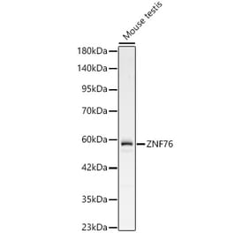 Western Blot - Anti-ZNF76 Antibody (A329985) - Antibodies.com