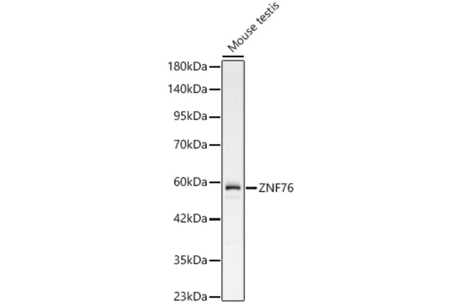 Western Blot - Anti-ZNF76 Antibody (A329985) - Antibodies.com