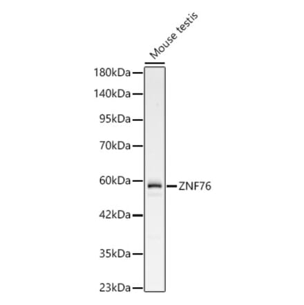 Western Blot - Anti-ZNF76 Antibody (A329985) - Antibodies.com