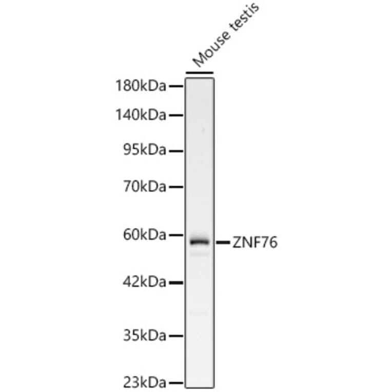 Western Blot - Anti-ZNF76 Antibody (A329985) - Antibodies.com