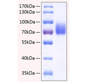 SDS-PAGE - Recombinant Human 2B4 Protein (C-terminal Human Fc and His Tag) (A330054) - Antibodies.com