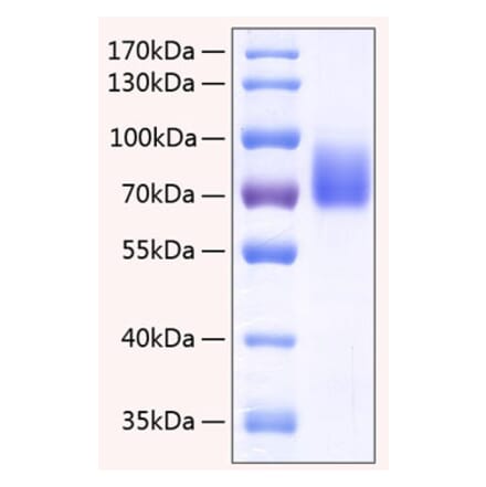 SDS-PAGE - Recombinant Human 2B4 Protein (C-terminal Human Fc and His Tag) (A330054) - Antibodies.com