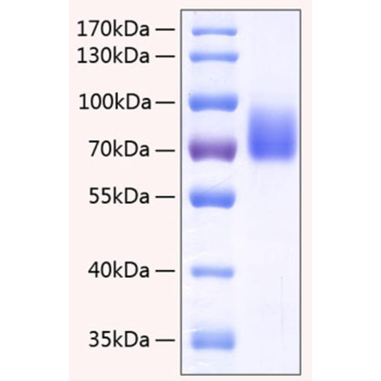 SDS-PAGE - Recombinant Human 2B4 Protein (C-terminal Human Fc and His Tag) (A330054) - Antibodies.com