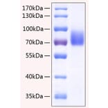 SDS-PAGE - Recombinant Human 2B4 Protein (C-terminal Human Fc and His Tag) (A330054) - Antibodies.com