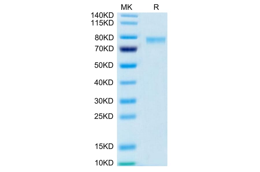 Tris-Bis PAGE - Recombinant Human 4-1BBL Protein (Biotin) (N-terminal monomeric Human Fc Tag) (A330056) - Antibodies.com