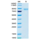 Tris-Bis PAGE - Recombinant Human 4-1BBL Protein (Biotin) (N-terminal monomeric Human Fc Tag) (A330056) - Antibodies.com
