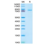 Tris-Bis PAGE - Recombinant Human 4-1BBL Protein (N-terminal monomeric Human Fc Tag) (A330057) - Antibodies.com