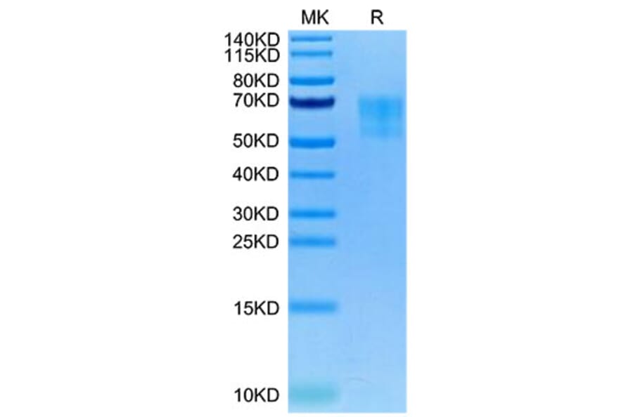 Tris-Bis PAGE - Recombinant Human 5T4 Protein (Biotin) (C-terminal His and Avi Tag) (A330059) - Antibodies.com