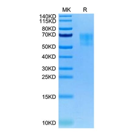 Tris-Bis PAGE - Recombinant Human 5T4 Protein (Biotin) (C-terminal His and Avi Tag) (A330059) - Antibodies.com