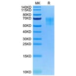 Tris-Bis PAGE - Recombinant Human 5T4 Protein (Biotin) (C-terminal His and Avi Tag) (A330059) - Antibodies.com