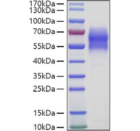 SDS-PAGE - Recombinant Human 5T4 Protein (C-terminal His Tag) (A330060) - Antibodies.com