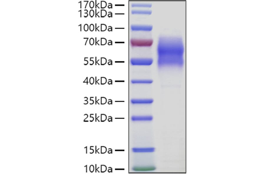SDS-PAGE - Recombinant Human 5T4 Protein (C-terminal His Tag) (A330060) - Antibodies.com