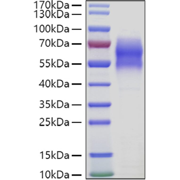 SDS-PAGE - Recombinant Human 5T4 Protein (C-terminal His Tag) (A330060) - Antibodies.com