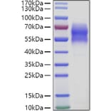 SDS-PAGE - Recombinant Human 5T4 Protein (C-terminal His Tag) (A330060) - Antibodies.com