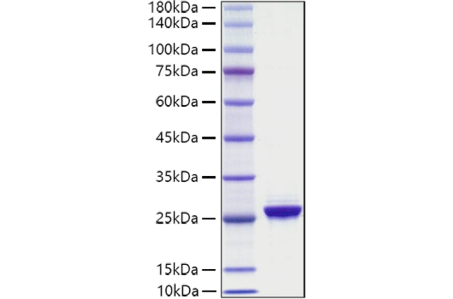 SDS-PAGE - Recombinant Human NF-L Protein (A330061) - Antibodies.com