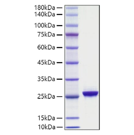 SDS-PAGE - Recombinant Human NF-L Protein (A330061) - Antibodies.com