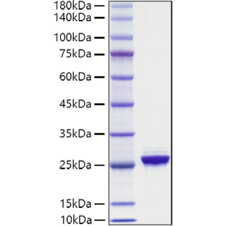 SDS-PAGE - Recombinant Human NF-L Protein (A330061) - Antibodies.com