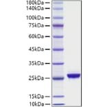 SDS-PAGE - Recombinant Human NF-L Protein (A330061) - Antibodies.com