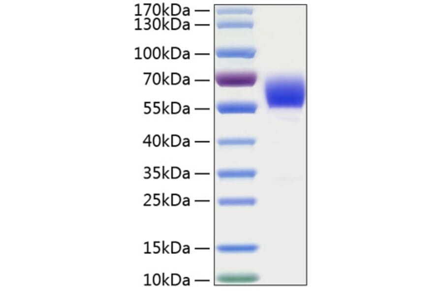 SDS-PAGE - Recombinant Human AACT Protein (C-terminal His Tag) (A330062) - Antibodies.com