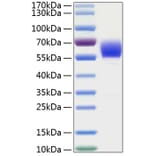 SDS-PAGE - Recombinant Human AACT Protein (C-terminal His Tag) (A330062) - Antibodies.com