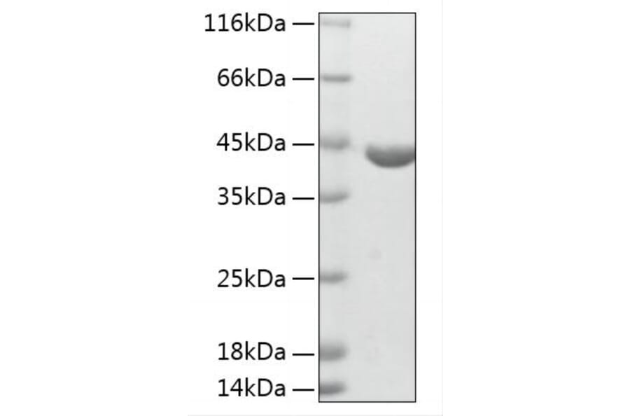 SDS-PAGE - Recombinant Human ABHD4 Protein (N-terminal His Tag) (A330063) - Antibodies.com