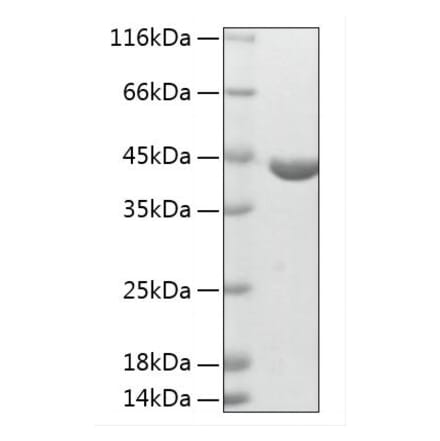 SDS-PAGE - Recombinant Human ABHD4 Protein (N-terminal His Tag) (A330063) - Antibodies.com