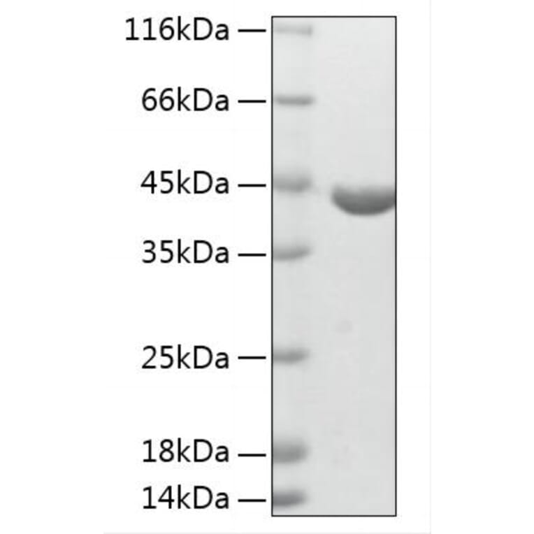 SDS-PAGE - Recombinant Human ABHD4 Protein (N-terminal His Tag) (A330063) - Antibodies.com