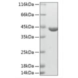 SDS-PAGE - Recombinant Human ABHD4 Protein (N-terminal His Tag) (A330063) - Antibodies.com