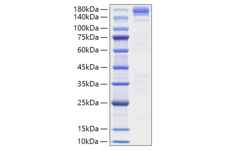 SDS-PAGE - Recombinant Human ACE Protein (N-terminal His Tag) (A330064) - Antibodies.com