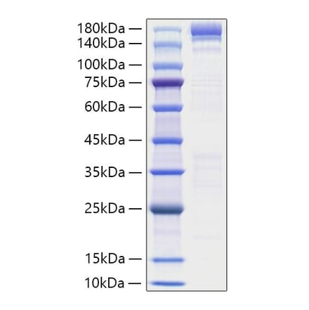 SDS-PAGE - Recombinant Human ACE Protein (N-terminal His Tag) (A330064) - Antibodies.com