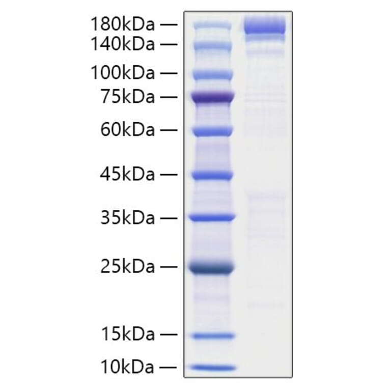 SDS-PAGE - Recombinant Human ACE Protein (N-terminal His Tag) (A330064) - Antibodies.com