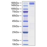 SDS-PAGE - Recombinant Human ACE Protein (N-terminal His Tag) (A330064) - Antibodies.com