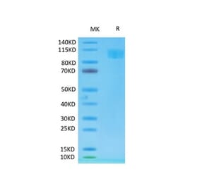 Tris-Bis PAGE - Recombinant Cynomolgus macaque ACE2 Protein (Biotin) (C-terminal His and Avi Tag) (A330065) - Antibodies.com