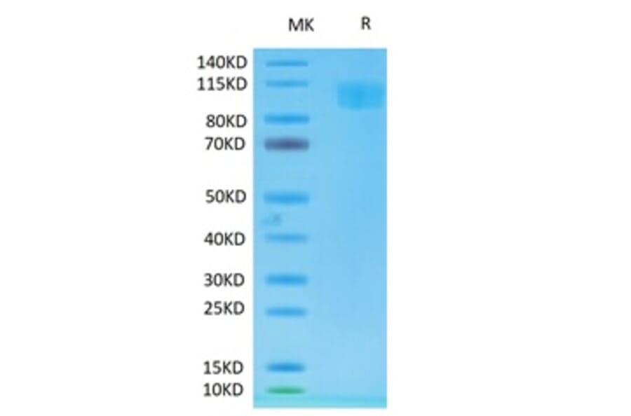 Tris-Bis PAGE - Recombinant Cynomolgus macaque ACE2 Protein (Biotin) (C-terminal His and Avi Tag) (A330065) - Antibodies.com