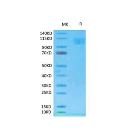 Tris-Bis PAGE - Recombinant Cynomolgus macaque ACE2 Protein (Biotin) (C-terminal His and Avi Tag) (A330065) - Antibodies.com