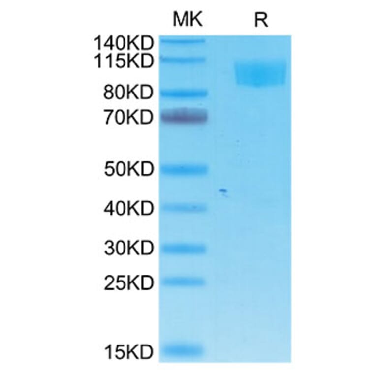 Tris-Bis PAGE - Recombinant Cynomolgus macaque ACE2 Protein (C-terminal His and Avi Tag) (A330066) - Antibodies.com