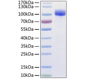 SDS-PAGE - Recombinant Human ACE2 Protein (C-terminal His and Avi Tag) (A330067) - Antibodies.com